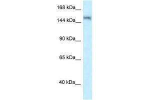 WB Suggested Anti-LRRK1 Antibody Titration: 1. (LRRK1 anticorps  (N-Term))
