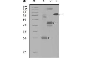 Western Blot showing MAP4K4 antibody used against truncated Trx-MAP4K4 recombinant protein (1), MBP-MAP4K4 (aa300-400) recombinant protein (2) and MAP4K4 (aa194-436)-hIgGFc transfected CH0-K1 cell lysate (3). (MAP4K4 anticorps  (AA 400-500))
