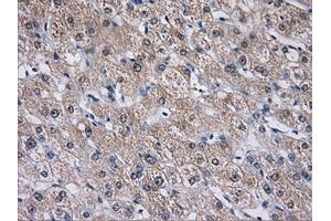 Immunohistochemical staining of paraffin-embedded liver tissue using anti-AKR1A1mouse monoclonal antibody. (AKR1A1 anticorps)