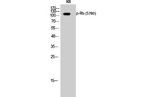 Western Blotting (WB) image for anti-Retinoblastoma 1 (RB1) (pSer780) antibody (ABIN5961788) (Retinoblastoma 1 anticorps  (pSer780))