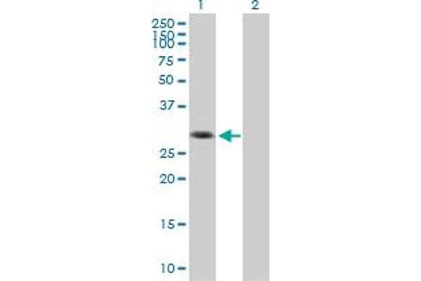 SIP1 anticorps  (AA 1-280)