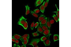 Immunofluorescence (IF) image for anti-Epithelial Cell Adhesion Molecule (EPCAM) (AA 20-60), (N-Term) antibody (ABIN6939994)