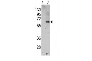 Western blot analysis of PRKAA2 using rabbit polyclonal PRKAA2 Antibody using 293 cell lysates (2 ug/lane) either nontransfected (Lane 1) or transiently transfected with the PRKAA2 gene (Lane 2). (PRKAA2 anticorps  (C-Term))