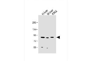 All lanes : Anti-MUT Antibody (Center) at 1:2000 dilution Lane 1: Human liver lysate Lane 2: Mouse liver lysate Lane 3: K562 whole cell lysate Lysates/proteins at 20 μg per lane. (MUT anticorps  (AA 492-526))