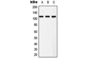 Western blot analysis of EPHB3 (pY608) expression in Hela (A), NIH3T3 (B), PC12 (C) whole cell lysates. (EPH Receptor B3 anticorps  (pTyr608))