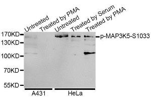 Western blot analysis of extracts of A-431 and HeLa cells, using Phospho-MAP3K5-S1033 antibody (ABIN5995640) at 1/1000 dilution. (ASK1 anticorps  (pSer1033))