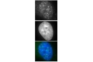 Immunohistochemistry (IHC) image for anti-DNA Repair Protein Homolog 1 (RAD51) antibody (ABIN2452093) (RAD51 anticorps)