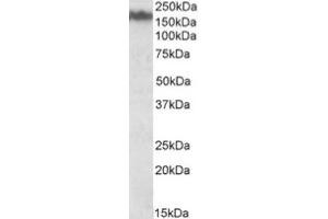 Image no. 1 for anti-Neurofilament Triplet M Protein (NEFM) (Internal Region) antibody (ABIN453988) (NEFM anticorps  (Internal Region))