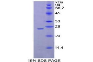 SDS-PAGE analysis of Mouse MPL Protein. (MPL Protéine)