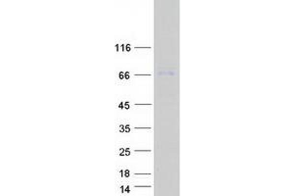 CPT2 Protein (Myc-DYKDDDDK Tag)