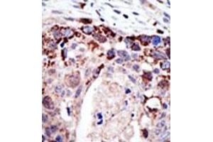 Image no. 2 for anti-Ataxin 3 (ATXN3) (N-Term) antibody (ABIN357621) (Ataxin 3 anticorps  (N-Term))