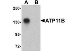 Western blot analysis of ATP11B in K562 cell tissue lysate with ATP11B antibody at 1 μg/ml in (A) the absence and (B) the presence of blocking peptide. (ATP11B anticorps  (N-Term))