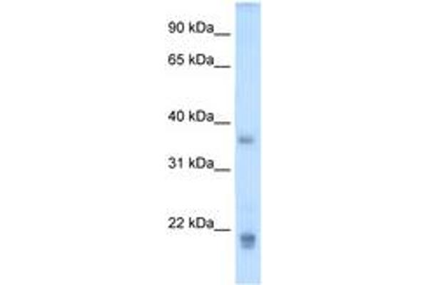 Growth Hormone 2 anticorps  (C-Term)