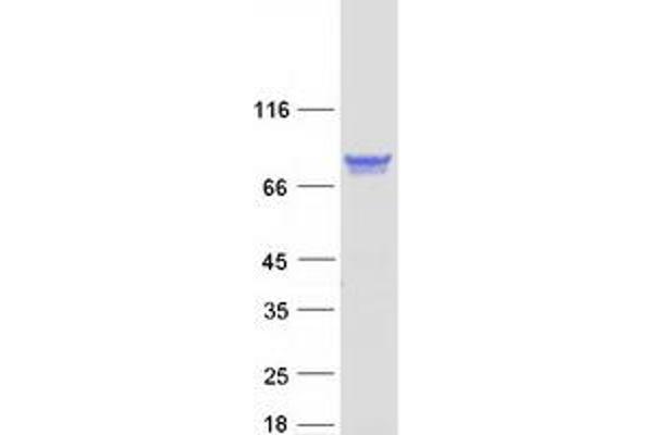 PPM1G Protein (Transcript Variant 1) (Myc-DYKDDDDK Tag)