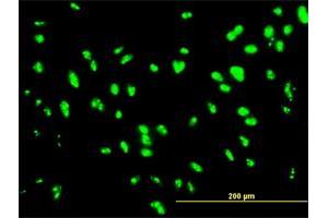 Immunofluorescence of monoclonal antibody to UBTF on HepG2 cell. (UBTF anticorps  (AA 551-650))