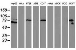 Image no. 2 for anti-Catenin (Cadherin-Associated Protein), beta 1, 88kDa (CTNNB1) antibody (ABIN1496895) (CTNNB1 anticorps)