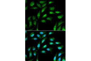Immunofluorescence analysis of MCF-7 cells using B2M antibody (ABIN5970743). (beta-2 Microglobulin anticorps)
