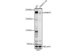 Western blot analysis of extracts from wild type (WT) and DNMT1 knockdown (KD) 293T cells, using DNMT1 antibody (ABIN7266808) at 1:1000 dilution. (DNMT1 anticorps)