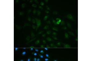 Immunofluorescence analysis of MCF-7 cells using CD79B Polyclonal Antibody (CD79b anticorps)