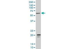 SMARCD3 monoclonal antibody (M02), clone 5F12 Western Blot analysis of SMARCD3 expression in K-562 . (SMARCD3 anticorps  (AA 385-483))