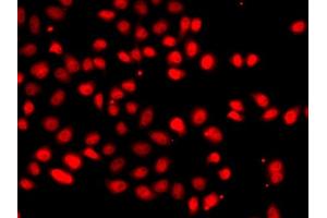 Immunofluorescence analysis of  cells using EP/HIF2α antibody (ABIN6127869, ABIN6141764, ABIN6141765 and ABIN6223457). (EPAS1 anticorps  (AA 588-870))