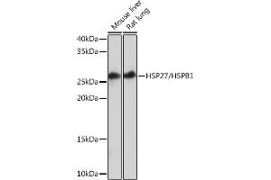 Western blot analysis of extracts of various cell lines, using HSP27/HSPB1Rabbit mAb (ABIN7267569) at 1:1000 dilution. (HSP27 anticorps)