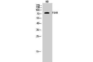 Western Blotting (WB) image for anti-Follicle Stimulating Hormone Receptor (FSHR) (Internal Region) antibody (ABIN3175168) (FSHR anticorps  (Internal Region))