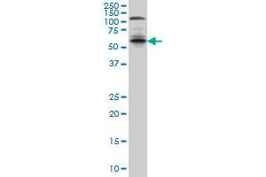 IRF5 monoclonal antibody (M04), clone 3C2 Western Blot analysis of IRF5 expression in A-431 . (IRF5 anticorps  (AA 395-504))
