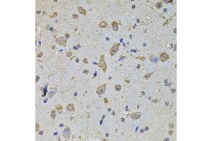 Immunohistochemistry of paraffin-embedded mouse brain using EIF4A2 antibody (ABIN5972034) at dilution of 1/100 (40x lens). (EIF4A2 anticorps)