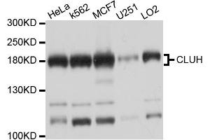 Western blot analysis of extracts of various cell lines, using CLUH antibody (ABIN6003838) at 1/1000 dilution. (CLUH anticorps)