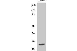 Western Blot analysis of various cells using Mob3B Polyclonal Antibody. (MOBKL2B anticorps  (AA 40-120))