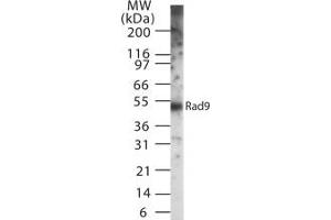 Image no. 1 for anti-RAD9 Homolog A (S. Pombe) (RAD9A) antibody (ABIN208030) (RAD9A anticorps)
