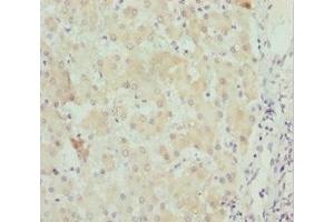 Immunohistochemistry of paraffin-embedded human liver tissue using ABIN7171258 at dilution of 1:100 (STXBP2 anticorps  (AA 1-280))