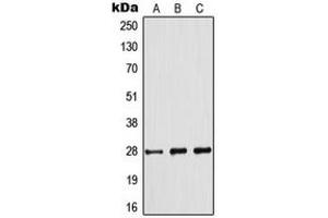 Western blot analysis of BCL2 (pS70) expression in Jurkat (A), THP1 (B), A2780 (C) whole cell lysates. (Bcl-2 anticorps  (pSer70))