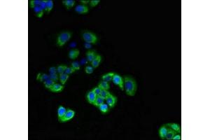 Immunofluorescent analysis of PC-3 cells using ABIN7172188 at dilution of 1:100 and Alexa Fluor 488-congugated AffiniPure Goat Anti-Rabbit IgG(H+L) (DIO3 anticorps  (AA 50-115))