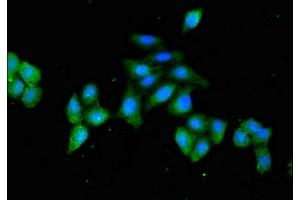 Immunofluorescent analysis of HepG2 cells using ABIN7154875 at dilution of 1:100 and Alexa Fluor 488-congugated AffiniPure Goat Anti-Rabbit IgG(H+L) (HSPA4 anticorps  (AA 1-148))