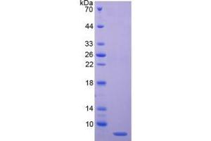 SDS-PAGE (SDS) image for Complement Component 4 Binding Protein, alpha (C4BPA) (AA 548-597) protein (His tag) (ABIN1079011) (C4BPA Protein (AA 548-597) (His tag))