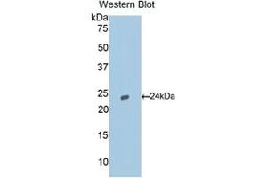 Western blot analysis of the recombinant protein. (Caspase 9 anticorps  (AA 1-200))