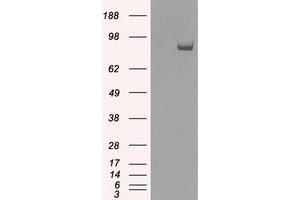 Western Blotting (WB) image for anti-SATB Homeobox 1 (SATB1) antibody (ABIN1500812) (SATB1 anticorps)