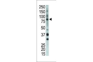 Antibody is used in Western blot to detect BMX in mouse heart tissue lysate. (BMX anticorps  (AA 212-242))