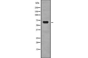 Western blot analysis of CD42b using MCF7 whole cell lysates (CD42b anticorps  (C-Term))