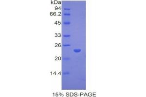 SDS-PAGE analysis of Rabbit PPARG Protein. (PPARG Protéine)