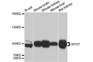 Western blot analysis of extracts of various cell lines, using XPOT antibody (ABIN5999202) at 1:3000 dilution. (XPOT anticorps)