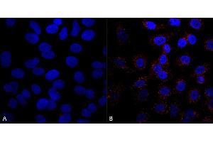 Immunocytochemistry/Immunofluorescence analysis using Mouse Anti-VPS35 Monoclonal Antibody, Clone 5A9 (ABIN6932953). (VPS35 anticorps  (PerCP))
