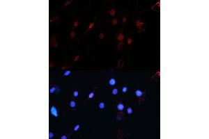 Immunofluorescence analysis of C6 using ZEB1 antibody (ABIN6129933, ABIN6150422, ABIN6150423 and ABIN6221237) at dilution of 1:100 (40x lens). (ZEB1 anticorps  (AA 1-260))