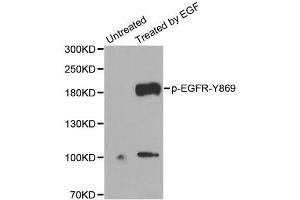 Western Blotting (WB) image for anti-Epidermal Growth Factor Receptor (EGFR) (pTyr869) antibody (ABIN1870109) (EGFR anticorps  (pTyr869))