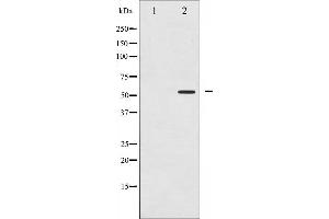 Western blot analysis of PPAR- gamma phosphorylation expression in Paclitaxel treated Jurkat whole cell lysates,The lane on the left is treated with the antigen-specific peptide. (PPARG anticorps  (pSer112))