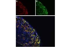 Colocalization of NaV1. (Synaptophysin anticorps  (Intravesicular Loop))