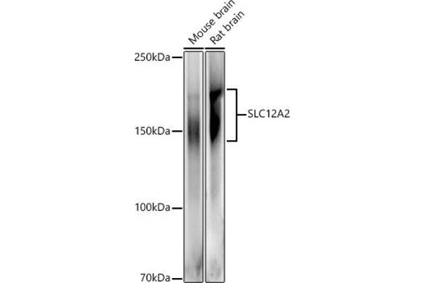 SLC12A2 anticorps  (AA 120-280)