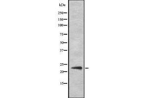 Western blot analysis of SOCS2 Antibody expression in Hela cells lysates. (SOCS2 anticorps)